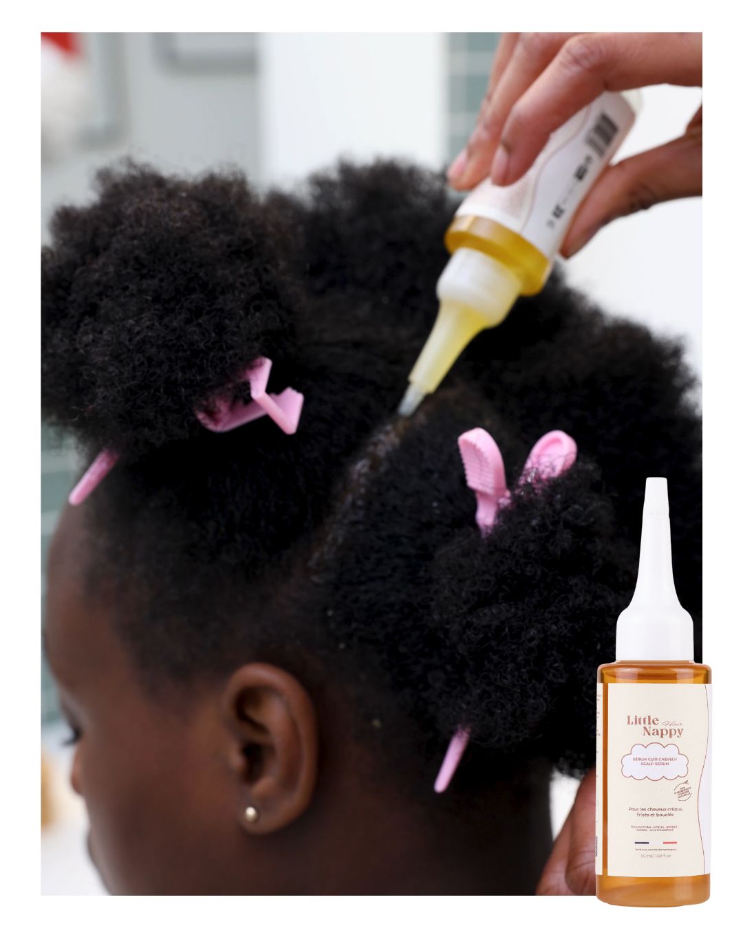 Prendre soin du cuir chevelu des enfants aux cheveux afro est ESSENTIEL Littlenappyhair